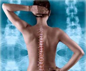 nugaros stuburo iliustracija