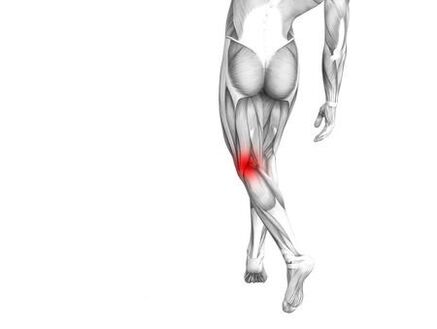 Kelio sąnario osteoartritas