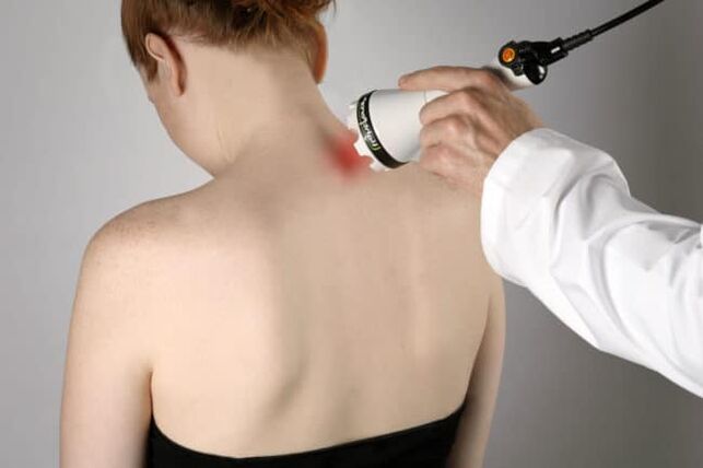 Lazerio terapija naudojama kovojant su nugaros skausmais pečių srityje. 