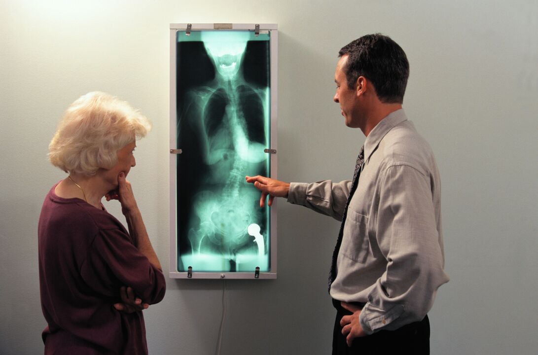 klubo sąnario skausmo rentgeno diagnostika