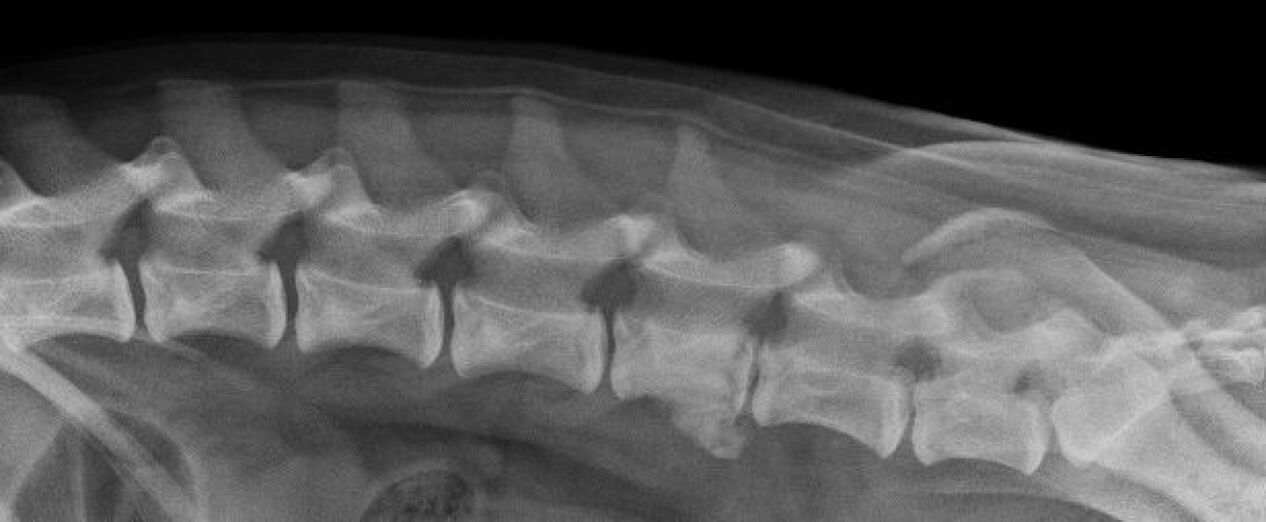 Krūtinės ląstos stuburo osteochondrozės apraiškos rentgeno nuotraukoje