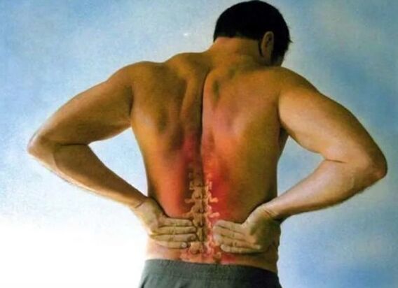 Juosmens osteochondrozės skausmas